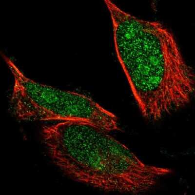 Immunocytochemistry/Immunofluorescence: NLK Antibody [NBP1-86047] - Immunofluorescent staining of human cell line U-251MG shows positivity in nucleus & nucleoli. Antibody staining is shown in green. 