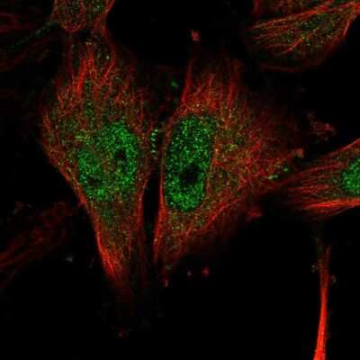 Immunocytochemistry/Immunofluorescence: NLK Antibody [NBP2-56662] - Staining of human cell line U-251 MG shows localization to nucleoplasm.