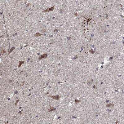 Immunohistochemistry: NLK Antibody [NBP2-56662] - Immunohistochemical staining of human cerebral cortex shows strong cytoplasmic positivity in a subset of neuronal and glial cells.