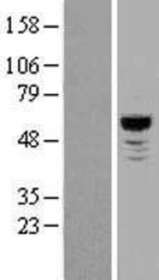 Western Blot: NLK Overexpression Lysate (Adult Normal) [NBL1-13669] Left-Empty vector transfected control cell lysate (HEK293 cell lysate); Right -Over-expression Lysate for NLK.
