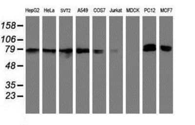 Western Blot: NLN Antibody (1D6) [NBP2-01693] Analysis of extracts (35ug) from 9 different cell lines by using anti-NLN monoclonal antibody (HepG2: human; HeLa: human; SVT2: mouse; A549: human; COS7: monkey; Jurkat: human; MDCK: canine; PC12: rat; MCF7: human).