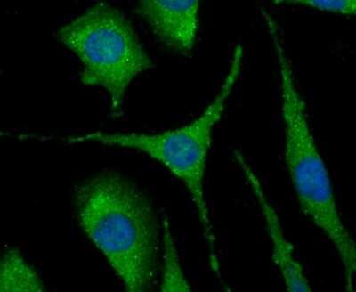 Immunocytochemistry/Immunofluorescence: NLRC3 Antibody [NBP2-75593] - Staining NLRC3 in SH-SY5Y cells (green). The nuclear counter stain is DAPI (blue). Cells were fixed in paraformaldehyde, permeabilised with 0.25% Triton X100/PBS.