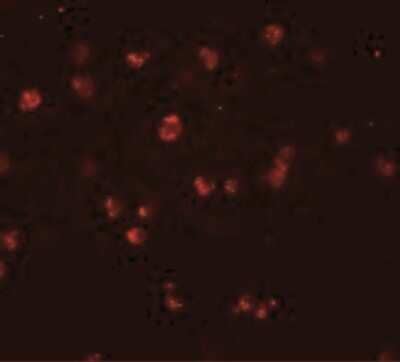 Immunocytochemistry/Immunofluorescence: NLRC3 Antibody [NBP2-41123] - Jurkat cells with NOD3 antibody at 20 ug/mL.