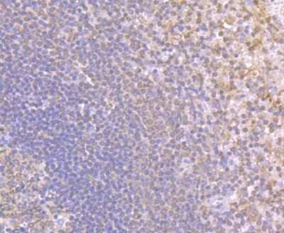 Immunohistochemistry-Paraffin: NLRC3 Antibody [NBP2-75593] - Analysis of paraffin-embedded human spleen tissue using anti-NLRC3 antibody. Counter stained with hematoxylin.