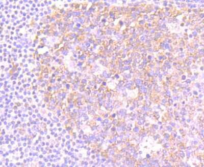 Immunohistochemistry-Paraffin: NLRC3 Antibody [NBP2-75593] - Analysis of paraffin-embedded human tonsil tissue using anti-NLRC3 antibody. Counter stained with hematoxylin.