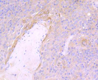Immunohistochemistry-Paraffin: NLRC3 Antibody [NBP2-75594] - Analysis of paraffin-embedded human tonsil tissue using anti-NLRC3 antibody. Counter stained with hematoxylin.