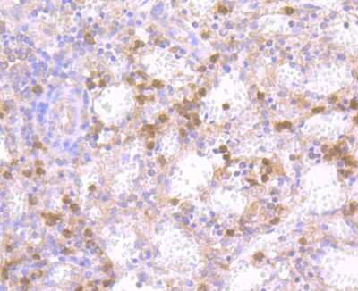 Immunohistochemistry-Paraffin: NLRC3 Antibody [NBP2-75594] - Analysis of paraffin-embedded human spleen tissue using anti-NLRC3 antibody. Counter stained with hematoxylin.