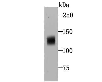 Western Blot: NLRC3 Antibody [NBP2-75593] - Analysis of NLRC3 on human thymus tissue lysates using anti-NLRC3 antibody at 1/500 dilution.