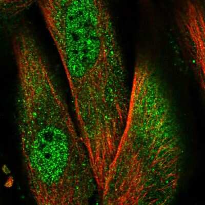 Immunocytochemistry/Immunofluorescence: NLRP1/NALP1 Antibody [NBP2-57196] - Staining of human cell line BJ shows localization to nucleoplasm & cytosol.