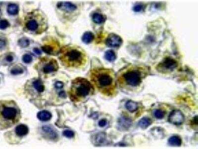 Immunohistochemistry-Paraffin: NLRP1/NALP1 Antibody [NB100-56147] - FFPE normal human bone marrow stained for NALP1 (CARD7/NAP) using NB100-56147 at 1:2000. Hematoxylin-eosin counterstain. Staining is seen in differentiated granulocytes.