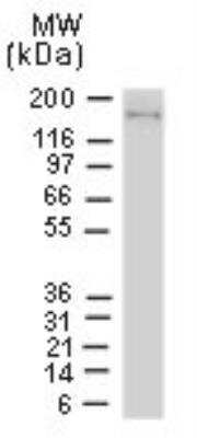 <b>Independent Antibodies Validation. </b>Immunoprecipitation: NLRP1/NALP1 Antibody [NB100-56147] - Analysis of NLRP1/NALP1(NAC/CARD7) in Jurkat cells using NB100-56148 and NB100-56147 NALP1 antibodies. Cell lysates were immunoprecipitated with NB100-56148 (2 uL/million cells) and Western blotted with NB100-56147 at 1:2000.