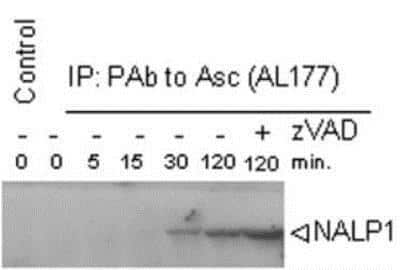 Western Blot: NLRP1/NALP1 Antibody (Nalpy1-4) [NBP1-97593] - Analysis of the time course of assembly of the inflammasome using MAb to NLRP1/NALP1 (Nalpy1-4) in THP-1 macrophages. Method: Assembly of the inflammasome was induced by shifting the temperature to 30C after hypotonic lysis. THP-1 cell extracts were immunoprecipitated using PAb to Asc (AL177) and run on SDS-PAGE. NLRP1/NALP1 was detected by MAb to NALP1 (Nalpy1-4) at 1:1000 dilution. Anti-mouse IgG coupled horse radish peroxidase was used at 1:5000 dilution for ECL detection. For more information about the 'time course assembly of inflammasome' method see F. Martinon; Mol. Cell. 10, 417 (2002).