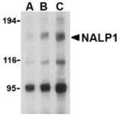 Western Blot: NLRP1/NALP1 Antibody [NBP1-76656] - U937 cell lysate with NALP1 antibody at (A) 1, (B) 2 and (C) 4 ug/ml.