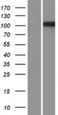 Western Blot: NLRP14 Overexpression Lysate (Adult Normal) [NBP2-05017] Left-Empty vector transfected control cell lysate (HEK293 cell lysate); Right -Over-expression Lysate for NLRP14.