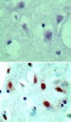 Immunohistochemistry-Paraffin: NLRP2/NALP2 Antibody [NBP2-24550] - Analysis of NALP2 in formalin-fixed, paraffin-embedded human brain tissue using an isotype control (top) and this antibody (bottom) at 5 ug/ml.