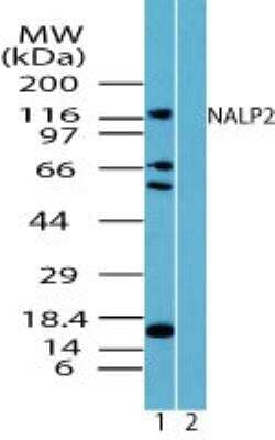 Western Blot: NLRP2/NALP2 Antibody [NBP2-24550] - Analysis of NALP2 in LNCAP cell lysate in the 1) absence and 2) presence of immunizing peptide using this antibody. 25 ug/ml. I goat anti-rabbit Ig HRP secondary antibody and PicoTect ECL substrate solution were used for this test.