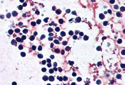 Immunohistochemistry-Paraffin: NLRP3/NALP3 Antibody [NBP2-76806] - Staining of paraffin embedded Human peripheral blood leukocytes. Steamed antigen retrieval with citrate buffer pH 6, AP-staining.