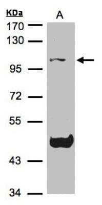 Western Blot: NLRP3/NALP3 Antibody [NBP1-31245] -  Sample(30 ug of whole cell lysate)A:Raji 7.5% SDS PAGE, antibody diluted at 1:1500.