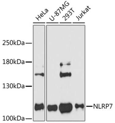 Western Blot: NLRP7 Antibody [NBP2-94507] - Analysis of extracts of various cell lines, using NLRP7 at 1:3000 dilution.Secondary antibody: HRP Goat Anti-Rabbit IgG (H+L) at 1:10000 dilution.Lysates/proteins: 25ug per lane.Blocking buffer: 3% nonfat dry milk in TBST.Detection: ECL Basic Kit .Exposure time: 40s.