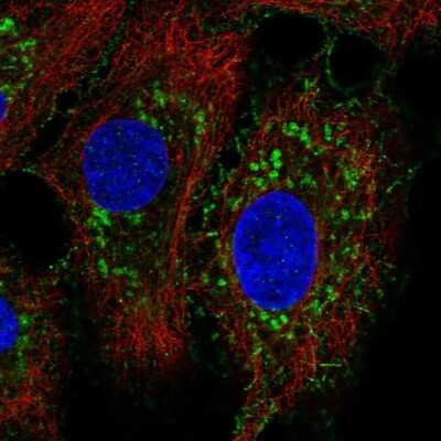 Immunocytochemistry/Immunofluorescence: NLRX1 Antibody [NBP2-56975] - Staining of human cell line A549 shows localization to plasma membrane & mitochondria.