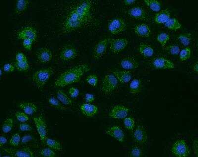 Immunocytochemistry/Immunofluorescence: NLRX1 Antibody [NBP3-12566] - Staining of NLRX1 in A549 cells. Cells were fixed with 4% PFA, permeabilzed with 0.1% Triton X-100 in PBS,blocked with 10% serum, and incubated with rabbit anti-Human NLRX1 polyclonal antibody (dilution ratio 1:200) at 4? overnight. Then cells were stained with the Alexa Fluor®488-conjugated Goat Anti-rabbit IgG secondary antibody (green) and counterstained with DAPI (blue).Positive staining was localized to Cytoplasm.