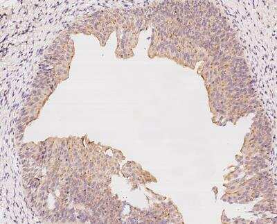 Immunohistochemistry-Paraffin: NLRX1 Antibody [NBP3-12566] - Staining of human NLRX1 in human urinary bladder with rabbit polyclonal antibody at 1:100 dilution.