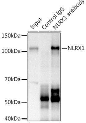 Immunoprecipitation: NLRX1 Antibody [NBP2-93355] - Analysis of 600ug extracts of Mouse kidney using 3ug NLRX1 antibody. Western blot was performed from the immunoprecipitate using NLRX1 at a dilition of 1:1000.