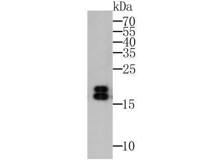 Western Blot: NM23-H1 Antibody (12A1) [NBP2-76900] - Western blot analysis of NM23 on MCF-7 cell lysate. Proteins were transferred to a PVDF membrane and blocked with 5% BSA in PBS for 1 hour at room temperature. The primary antibody was used at a 1:500 dilution in 5% BSA at room temperature for 2 hours. Goat Anti-Mouse IgG - HRP Secondary Antibody (HA1006) at 1:5,000 dilution was used for 1 hour at room temperature.