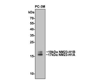 Western Blot: NM23-H1 Antibody (12A1) [NBP2-76900] - Analysis of NM23-H1 on PC-3M cell lysates with Mouse anti-NM23 antibody at 1/2,000 dilution. Lysates/proteins at 10 ug/Lane. Predicted band size: 17 kDa Observed band size: 17/19 kDa Exposure time: 30 seconds; 15% SDS-PAGE gel. Proteins were transferred to a PVDF membrane and blocked with 5% NFDM/TBST for 1 hour at room temperature. The primary antibody at 1/2,000 dilution was used in 5% NFDM/TBST at room temperature for 2 hours. Goat Anti-Mouse IgG - HRP Secondary Antibody at 1:100,000 dilution was used for 1 hour at room temperature.