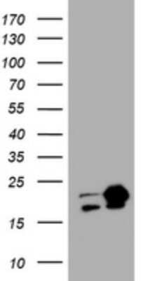 Western Blot: NM23-H1 Antibody (OTI4H2) - Azide and BSA Free [NBP2-73003] - Analysis of HEK293T cells were transfected with the pCMV6-ENTRY control (Left lane) or pCMV6-ENTRY NM23-H1.