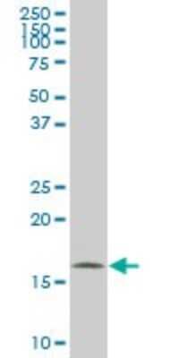 Western Blot: NM23-H2/NME2 Antibody (1D4) [H00004831-M05] - Analysis of NME2 expression in HeLa (Cat # L013V1).