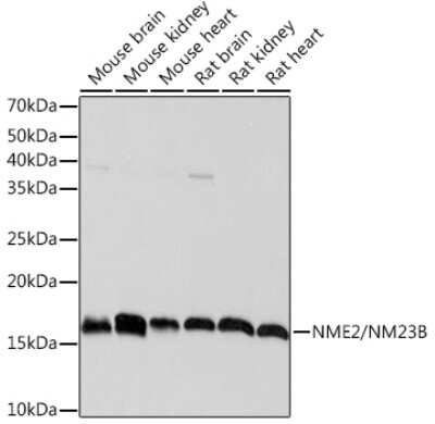 Western Blot: NM23-H2/NME2 Antibody (7L3A2) [NBP3-16606] - Western blot analysis of extracts of various cell lines, using NM23-H2/NME2 Rabbit mAb (NBP3-16606) at 1:1000 dilution. Secondary antibody: HRP Goat Anti-Rabbit IgG (H+L) at 1:10000 dilution. Lysates/proteins: 25ug per lane. Blocking buffer: 3% nonfat dry milk in TBST. Detection: ECL Basic Kit. Exposure time: 1s.