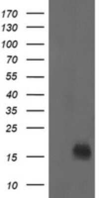 Western Blot: NM23-H2/NME2 Antibody (OTI2F9) - Azide and BSA Free [NBP2-73004] - Analysis of HEK293T cells were transfected with the pCMV6-ENTRY control (Left lane) or pCMV6-ENTRY NME2.