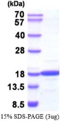 SDS-Page: NM23-H2/NME2 Recombinant Protein [NBP2-52251] - 15% SDS Page (3 ug)