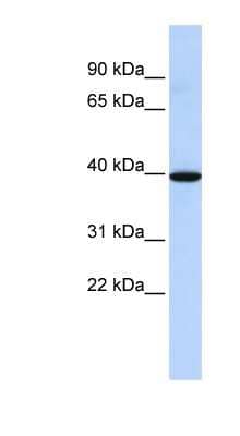 Western Blot: NMBR Antibody [NBP1-59024] - Human Brain lysate, concentration 0.2-1 ug/ml.