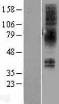 Western Blot: NMBR Overexpression Lysate (Adult Normal) [NBL1-13680] Left-Empty vector transfected control cell lysate (HEK293 cell lysate); Right -Over-expression Lysate for NMBR.