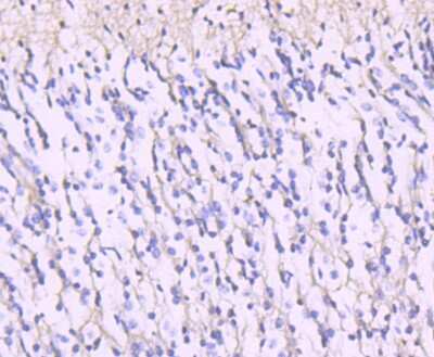 Immunohistochemistry-Paraffin: NMDAR2A Antibody (JA31-20) [NBP2-66984] - Analysis of paraffin-embedded human brain tissue using anti-NMDAR2A antibody. Counter stained with hematoxylin.