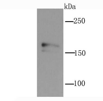 Western Blot: NMDAR2A Antibody (JA31-20) [NBP2-66984] - Analysis of NMDAR2A on rat brain tissue lysate using anti-NMDAR2A antibody at 1/1,000 dilution.