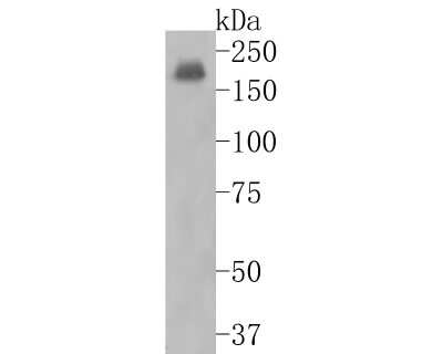Western Blot: NMDAR2A Antibody (JA31-20) [NBP2-66984] - Western blot analysis of NMDAR2A on mouse hippocampus tissue lysates. Proteins were transferred to a PVDF membrane and blocked with 5% BSA in PBS for 1 hour at room temperature. The primary antibody (1/500) was used in 5% BSA at room temperature for 2 hours. Goat Anti-Rabbit IgG - HRP Secondary Antibody (HA1001) at 1:5,000 dilution was used for 1 hour at room temperature.