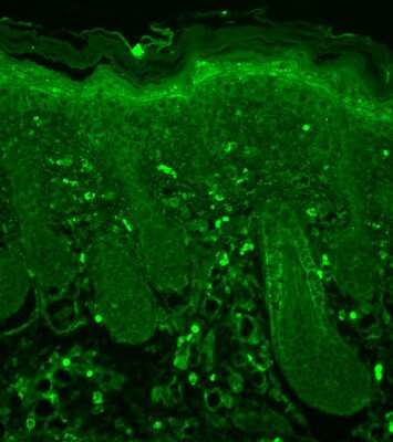 Immunohistochemistry-Paraffin: NMDAR2B Antibody (S59-20) [NBP1-47608] - analysis using Mouse Anti-GluN2B/NR2B Monoclonal Antibody, Clone S59-20 . Tissue: backskin. Species: Mouse. Fixation: Bouins Fixative and paraffin-embedded. Primary Antibody: Mouse Anti-GluN2B/NR2B Monoclonal Antibody at 1:100 for 1 hour at RT. Secondary Antibody: FITC Goat Anti-Mouse (green) at 1:50 for 1 hour at RT. Localization: Positive (dull) suprabasal staining in the epidermis and some hair follicle localization.