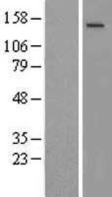 Western Blot NMDAR2C Overexpression Lysate