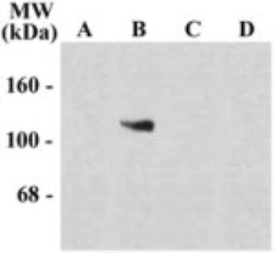 Western Blot: NMDAR2C Splice Variant Antibody [NB300-116] - Western blot of 10 ug of HEK 293 cells expression. (Lane A) NR1-subunit that does not contain the NR1 Insert (Mock). (Lane B) NR1-subunit containing only the C2 Insert. (Lane C) NR1-subunit containing the C1 and C2 in sert. (Lane D) NR1-subunit containing the C1/C2' and N1/C2' insert.