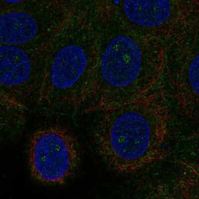 Immunocytochemistry/Immunofluorescence: NMDARA1 Antibody [NBP1-92187] - Staining of human cell line MCF7 shows localization to nucleoli fibrillar center.