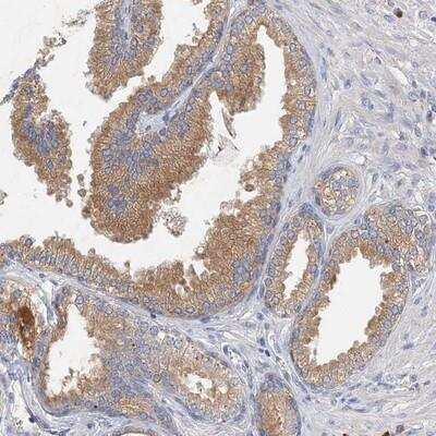 Immunohistochemistry: NMDARA1 Antibody [NBP1-89677] - Staining of human prostate shows moderate cytoplasmic positivity in glandular cells.