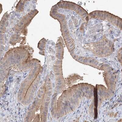 Immunohistochemistry-Paraffin: NMDARA1 Antibody [NBP1-92187] - Staining of human gallbladder shows moderate cytoplasmic positivity in glandular cells.