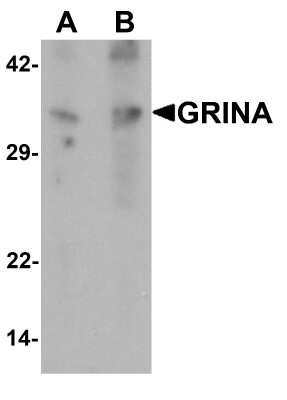 Western Blot: NMDARA1 Antibody [NBP2-81973] - Western blot analysis of NMDARA1 in human testis tissue lysate with NMDARA1 antibody at (A) 1 and (B) 2 ug/mL.
