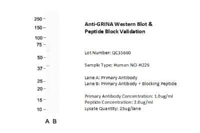 Western Blot: NMDARA1 Antibody [NBP2-85387] - Host: Rabbit. Target Name: GRINA. Sample Type: Human NCI-H226. Lane A: Primary Antibody. Lane B: Primary Antibody + Blocking Peptide. Primary Antibody Concentration: 1.0 ug/ml. Peptide Concentration: 2.0 ug/ml. Lysate Quantity: 25 ug/lane