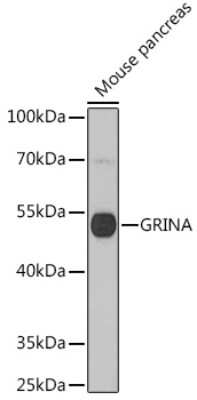 Western Blot NMDARA1 Antibody - Azide and BSA Free