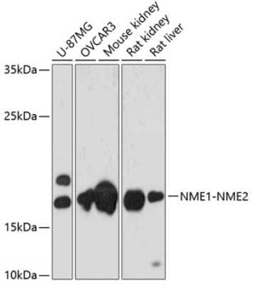Western Blot: NME1-NME2 Antibody [NBP3-05576] - Western blot analysis of extracts of various cell lines, using NME1-NME2 antibody (NBP3-05576) at 1:3000 dilution. Secondary antibody: HRP Goat Anti-Rabbit IgG (H+L) at 1:10000 dilution. Lysates/proteins: 25ug per lane. Blocking buffer: 3% nonfat dry milk in TBST. Detection: ECL Basic Kit. Exposure time: 30s.