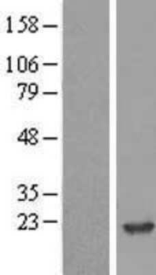 Western Blot NM23-H2/NME2 Overexpression Lysate